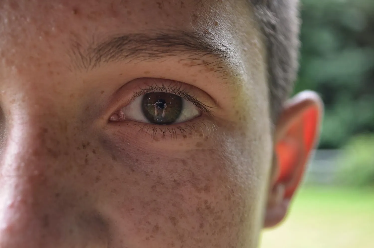 Parpadeo excesivo adultos